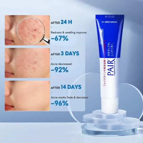 lion-pair-acne-cream-w-24g-idakorea